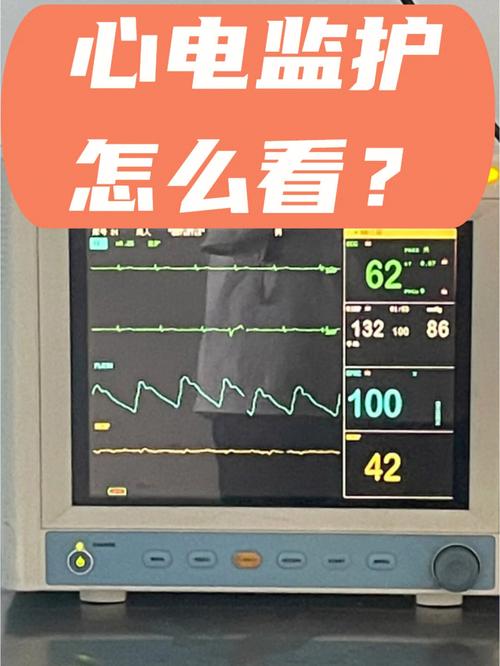 心电记录仪故障维修,心电记录仪故障维修多少钱2024/6/